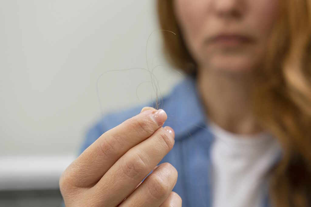 Hair loss