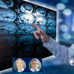 multiple sclerosis