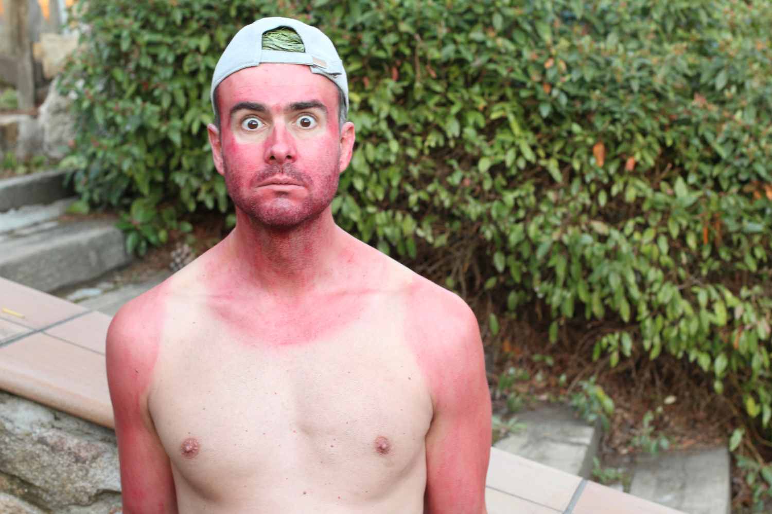 extreme tanning