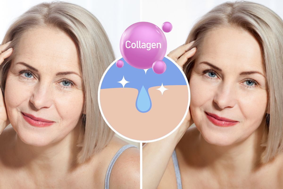 Skin & collagen