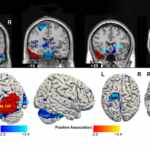brain and psychopathy