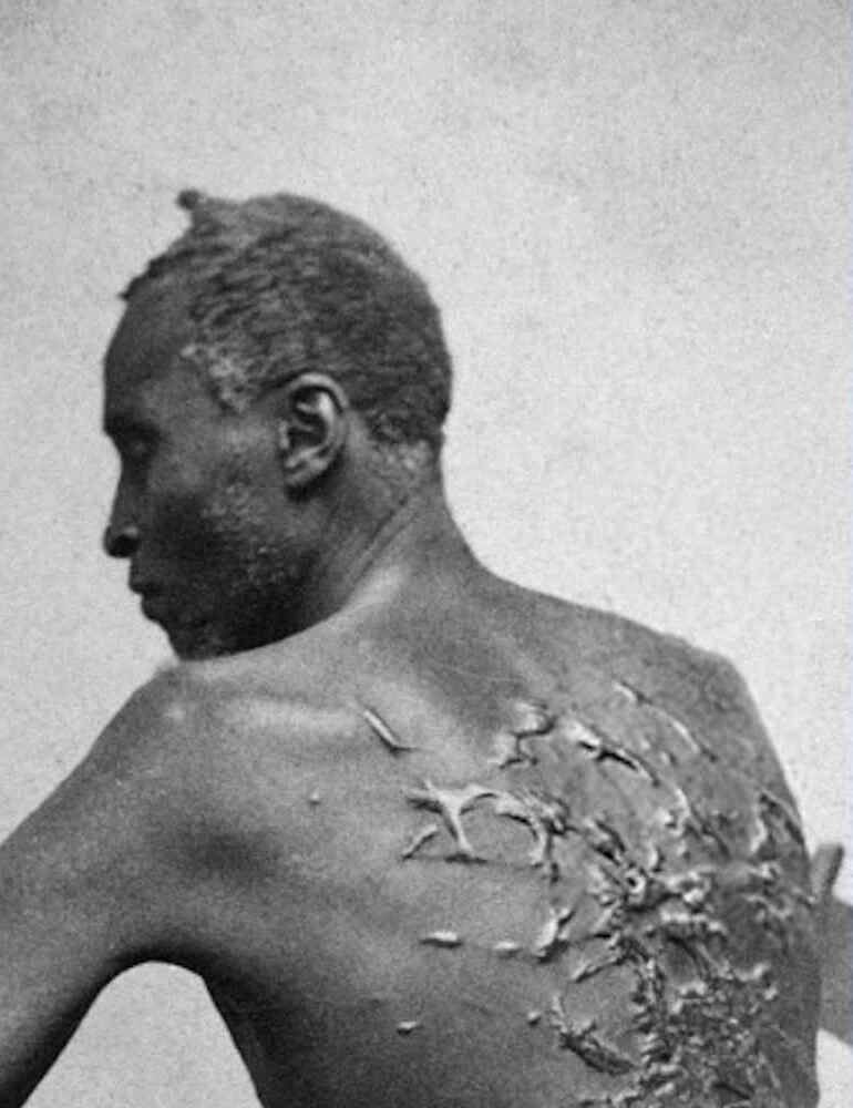 The Scourged Back